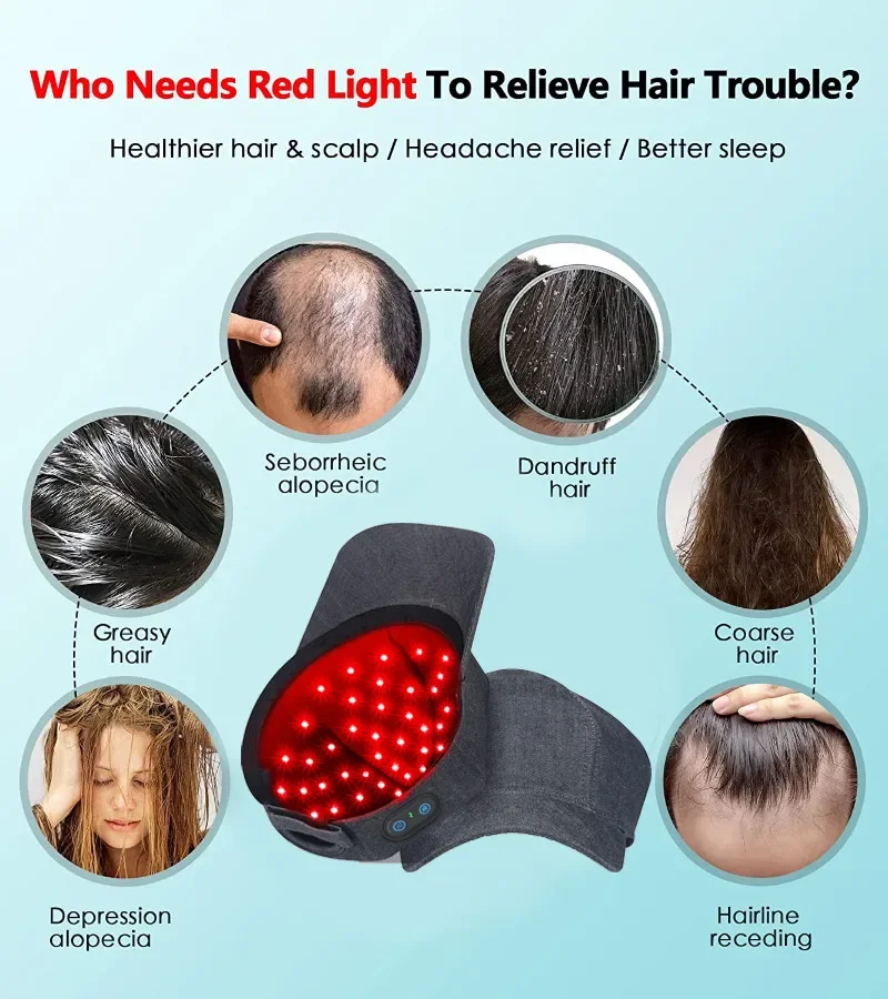 Czapka na porost włosów akumul – Hair Care Basic recenzja i cena