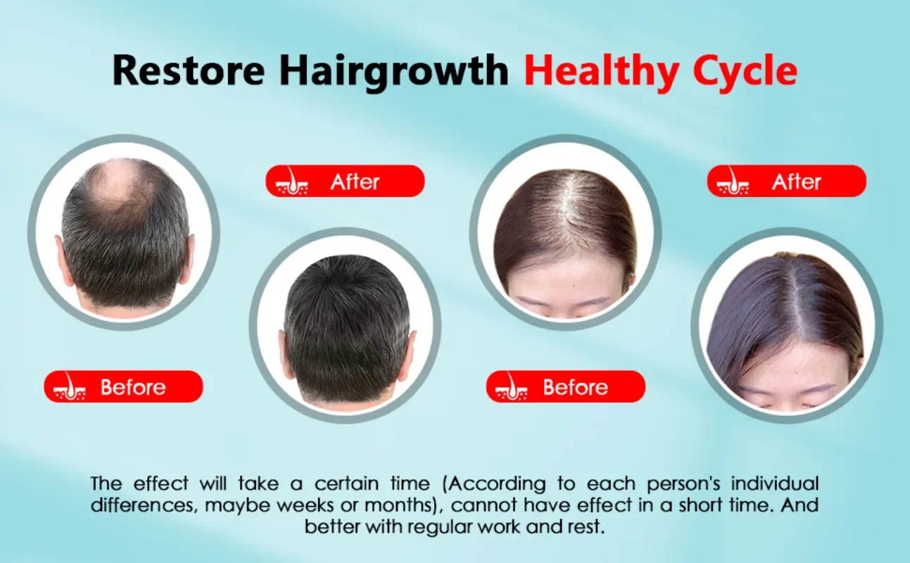 Czapka na porost włosów akumul – Hair Care Basic recenzja i cena